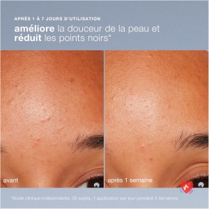 Dermalogica Daily Microfoliant - Iconic Gentle Daily Exfoliant with Rice Powder. Smoothes skin texture, evens and brightens complexion