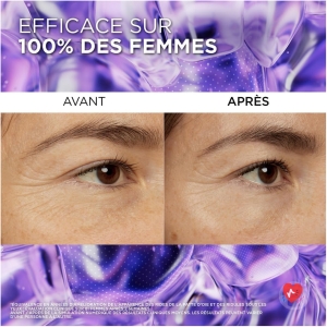 L'Oréal Paris - Eye Serum - Anti-Wrinkle, Anti-Puffiness & Concealer - With Pure Hyaluronic Acid and Caffeine - Innovative Triple-Ball Tip - Revitalift Filler - 20ml
