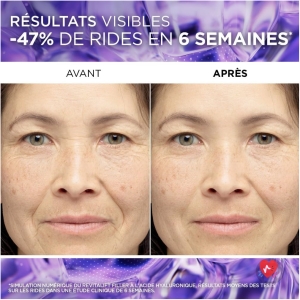 Revitalift Filler Sérum acide hyaluronique 1,5 %