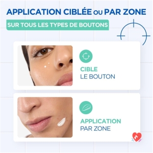 Soin anti boutons ciblé Pimple Paste