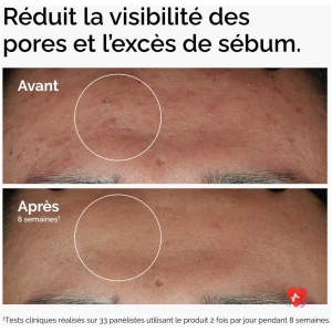 The Ordinary Niacinamide 10% + Zinc 1%, Sérum illuminant et lissant, pour les peaux sujettes aux imperfections, 30 ml